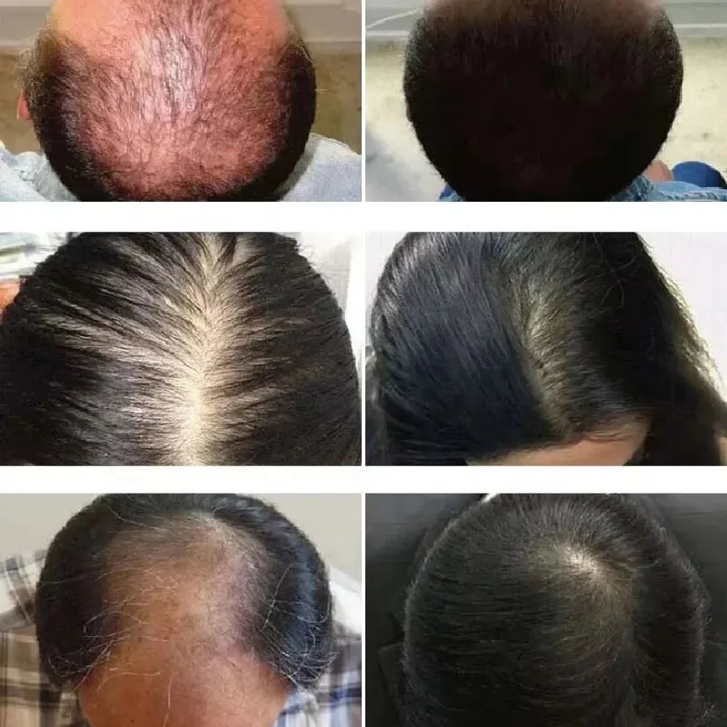 Rosemary Hair Growth Oil Anti  - Hair Care Ouai incelemesi ve fiyatı