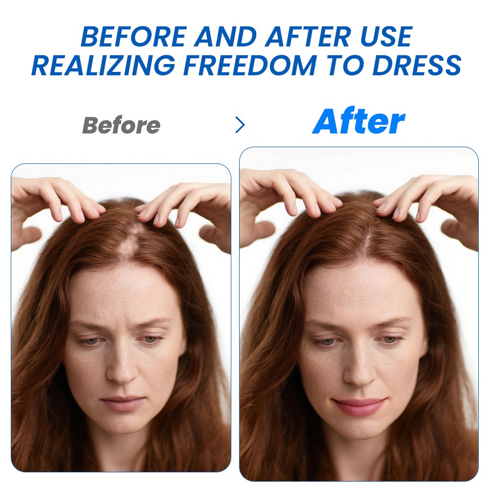 Alopecia Hair Growth Spray Sop - Hair Care Spray incelemesi ve fiyatı