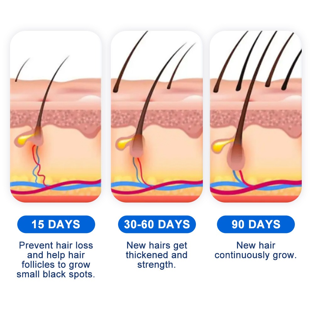 Alopecia Hair Growth Spray Sop - Hair Care Spray incelemesi ve fiyatı
