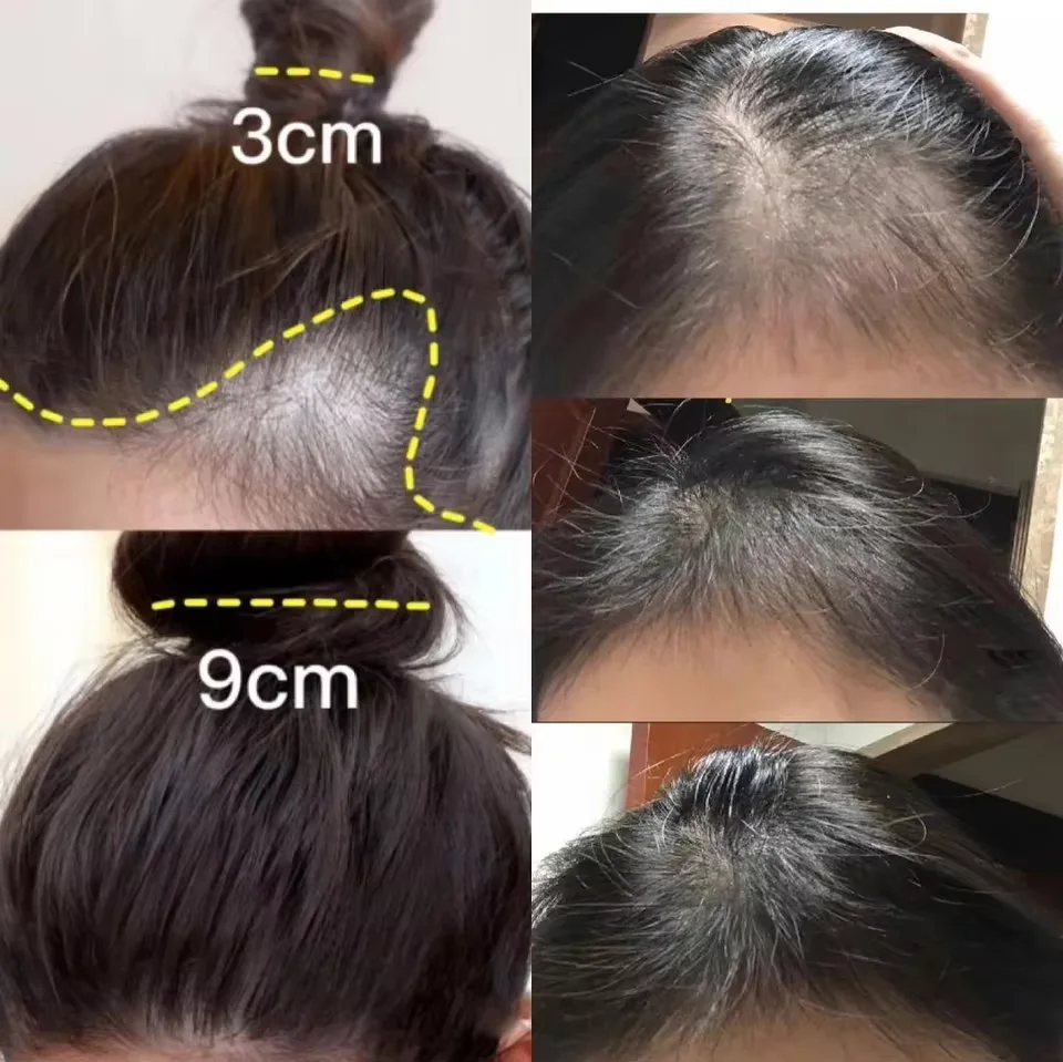 Fast Ginger Hair Growth Cream  - Hair Care Dupes incelemesi ve fiyatı