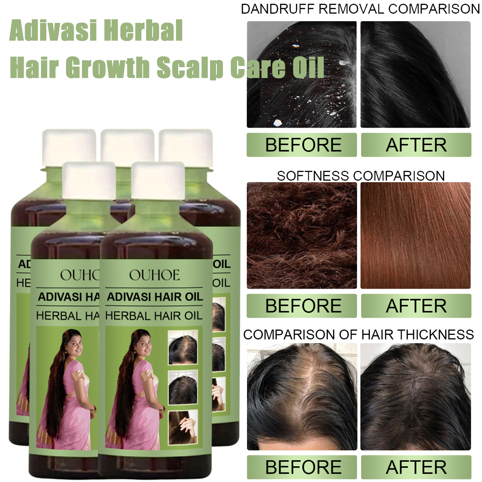 100ml Hair Growth Oil India Ad - Hair Care Ouai incelemesi ve fiyatı