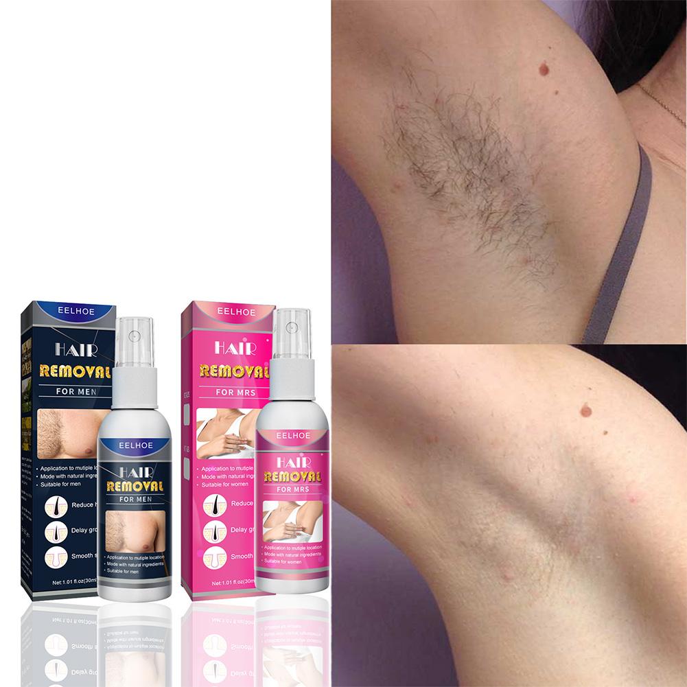 1/2PCS Super Natural Painless  - Hair Care Spray incelemesi ve fiyatı