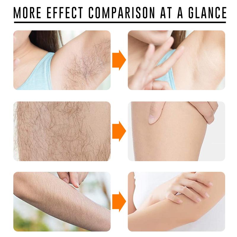 Fast Hair Removal Spray Painle - Hair Care Spray incelemesi ve fiyatı